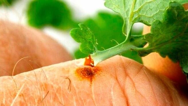 Apply celandine juice to warts
