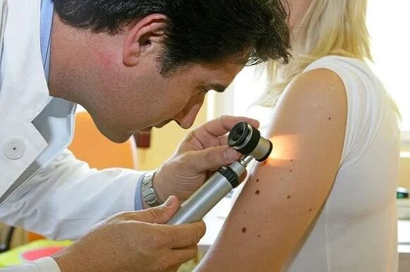 Diagnosis of papilloma