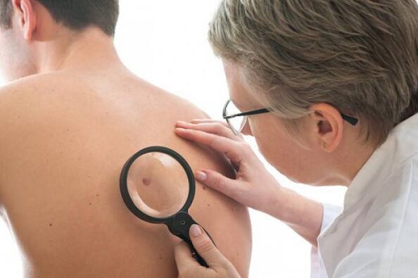Doctor examines papillomas on back
